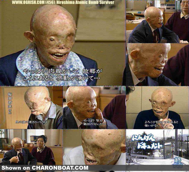 12207-hiroshima-victim-survivor.jpg