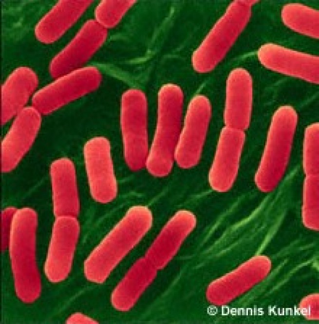 28142-bacterie-eschericia-coli.jpg
